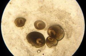 吃瓜小虫子视频